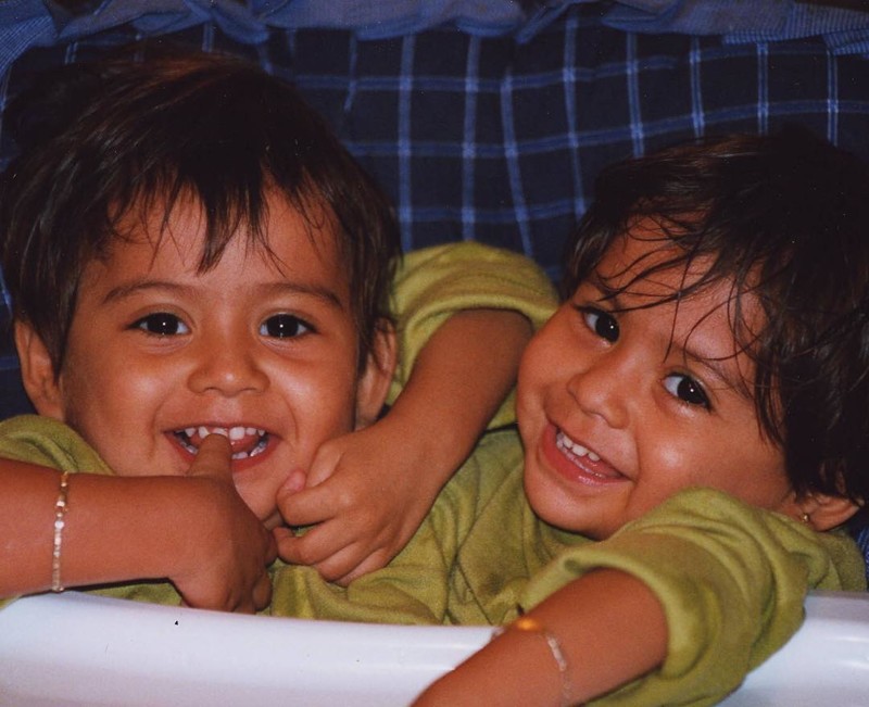 Лупита и Кармен Невероятная жизнь девочек-сиамских близнецов