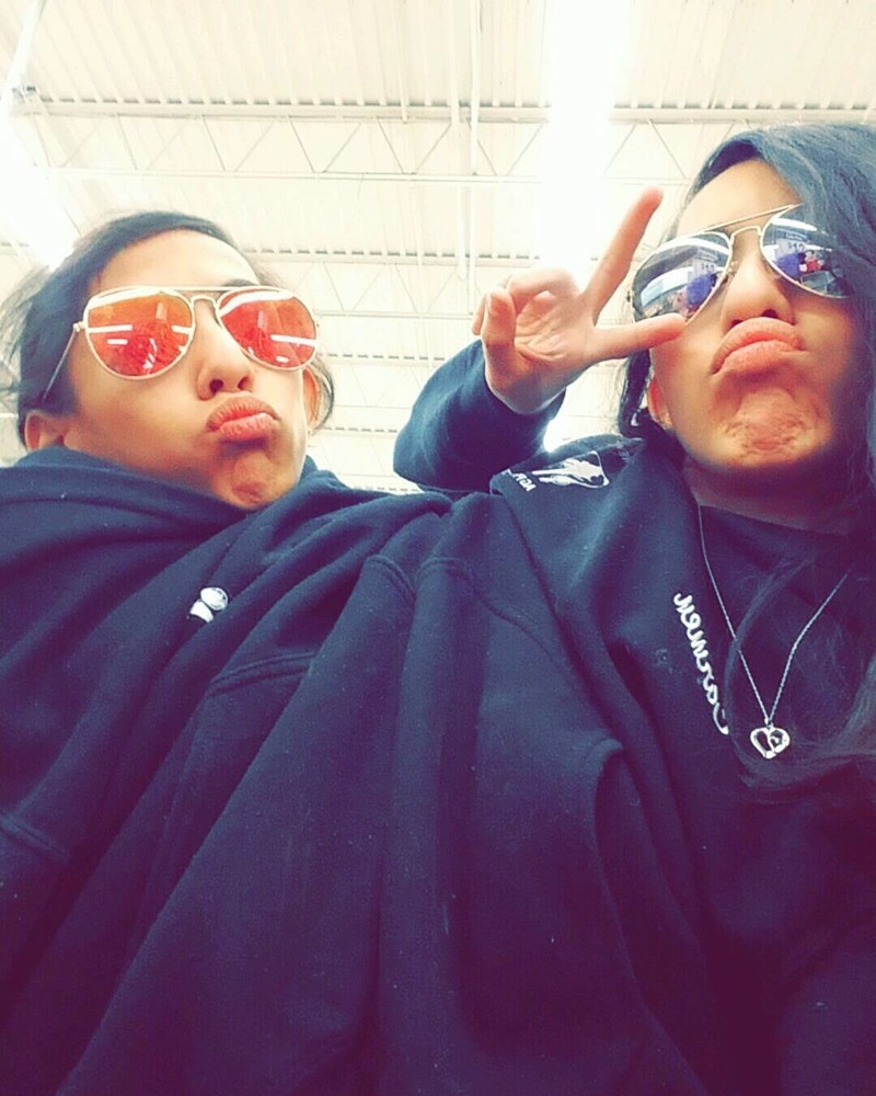 Лупита и Кармен Невероятная жизнь девочек-сиамских близнецов