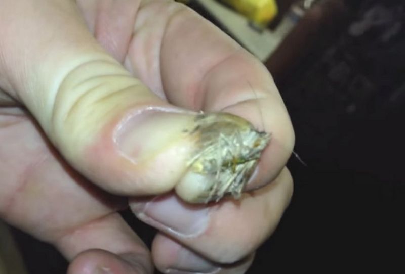 Друзья вытащили из уха американца двух животных