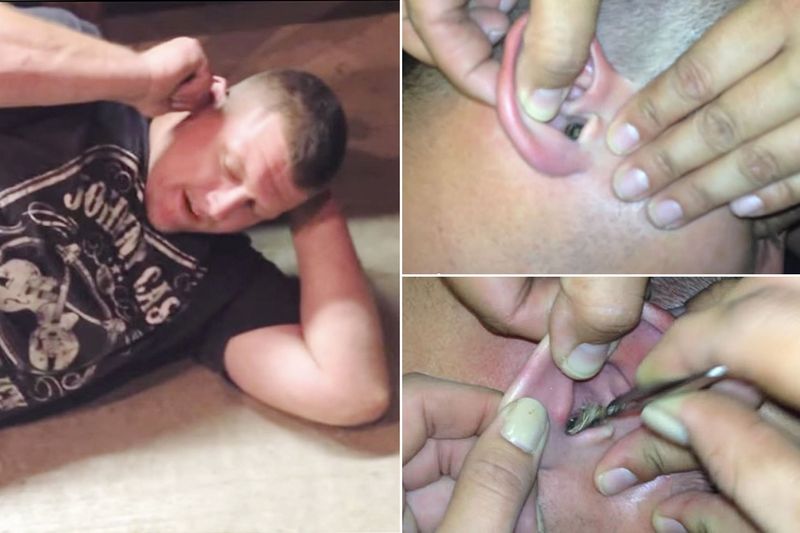 Друзья вытащили из уха американца двух животных