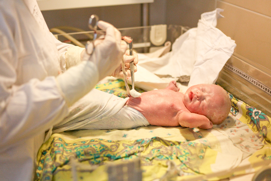 Кесарево сечение своими глазами