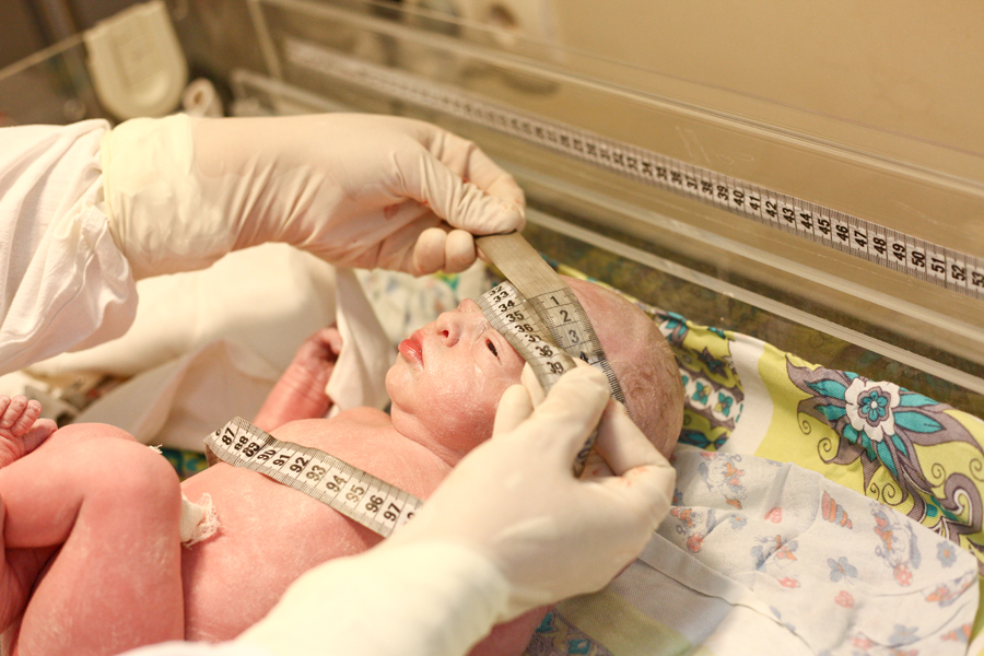 Кесарево сечение своими глазами