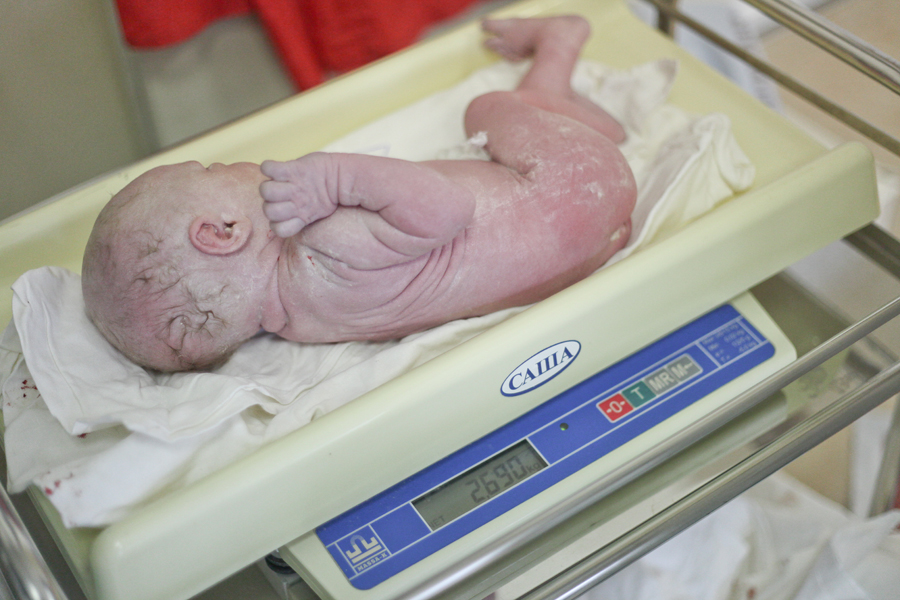 Кесарево сечение своими глазами