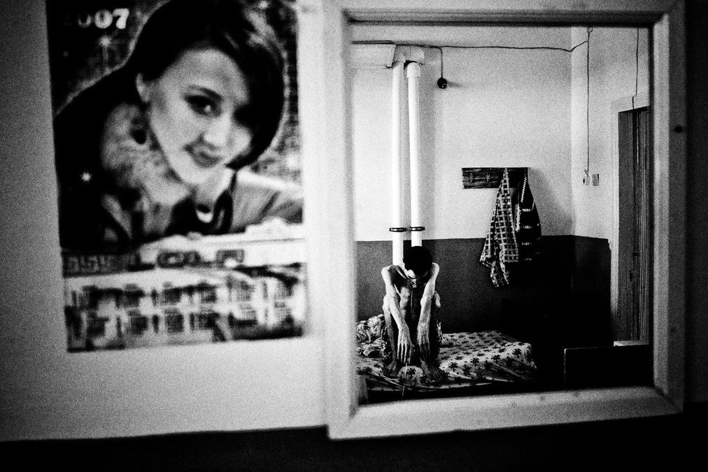 Туберкулез в СССР Туберкулез в СССР