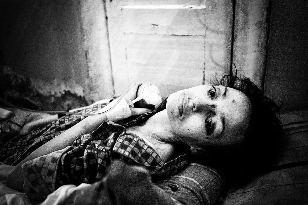 Туберкулез в СССР Туберкулез в СССР