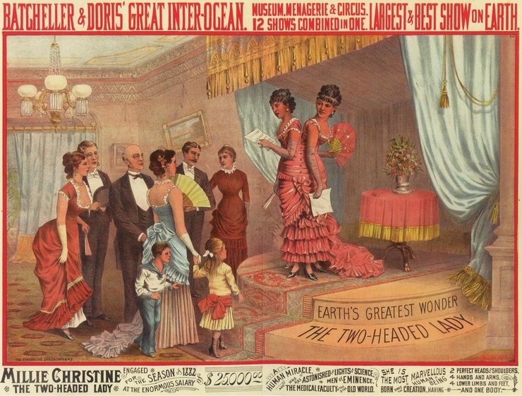 Удивительные истории о сиамских близнецах, у которых всё сложилось хорошо