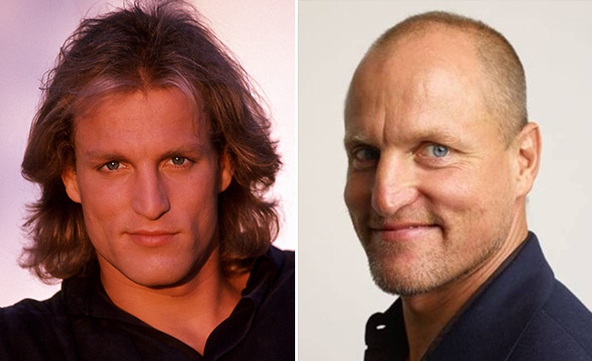 11 знаменитостей, которых лысина только красит