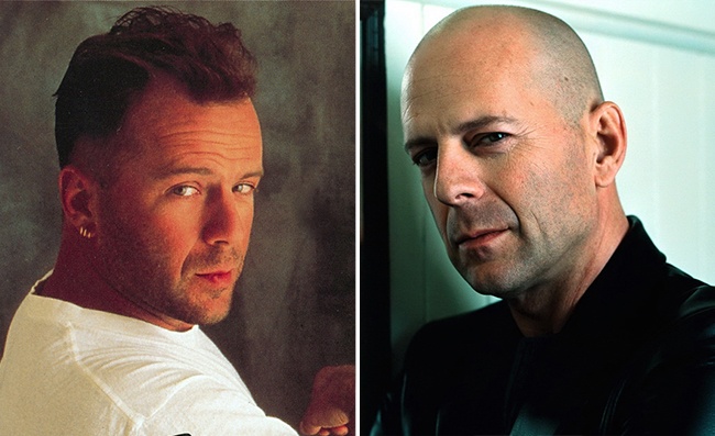 11 знаменитостей, которых лысина только красит