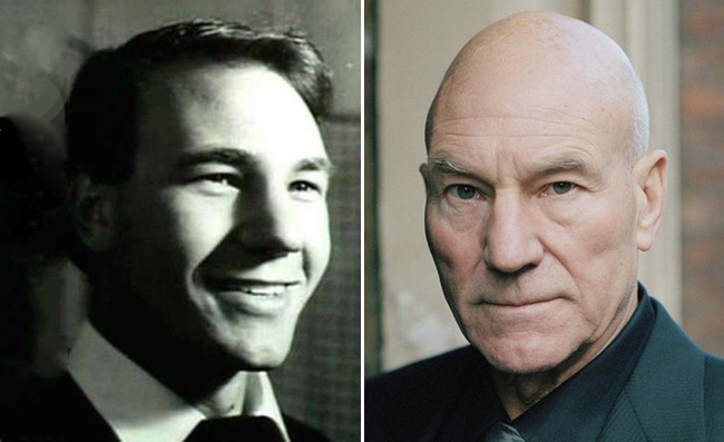 11 знаменитостей, которых лысина только красит