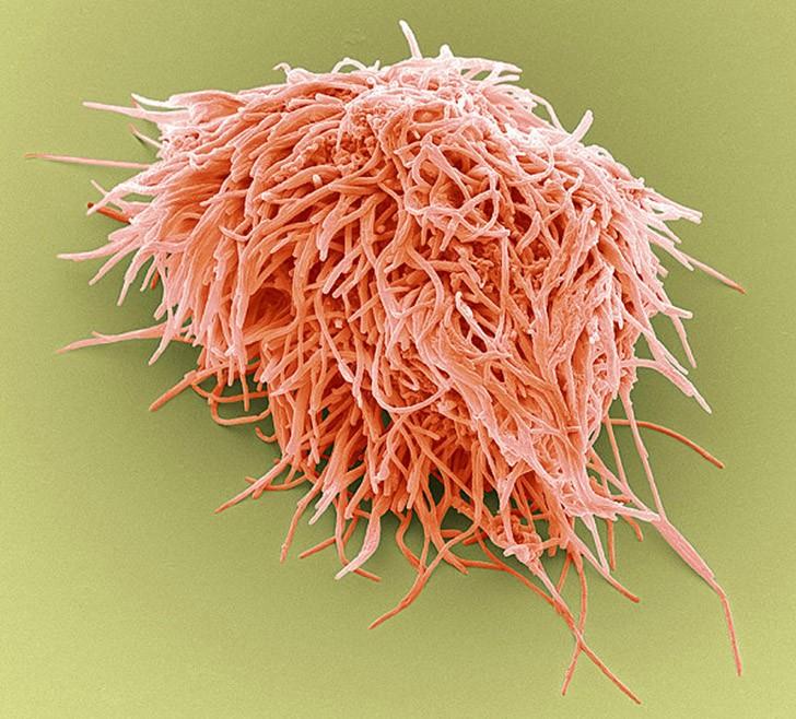 То, что таится у вас во рту, очень крупным планом То, что таится у вас во рту, очень крупным планом