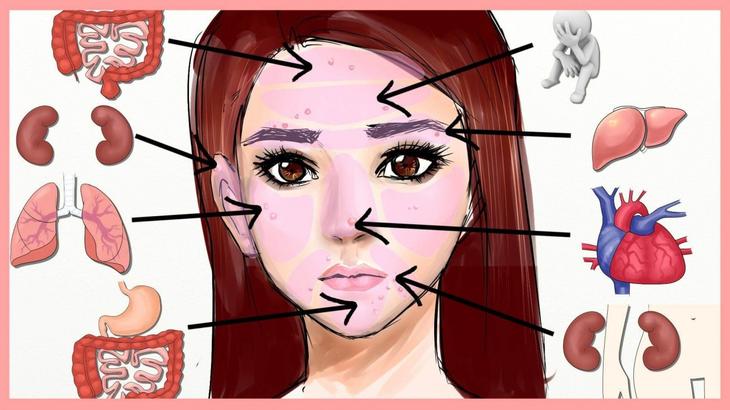 Карта прыщей на лице: что они означают? Расположение прыщей на лице и болезни Карта прыщей на лице: что они означают? Расположение прыщей на лице и болезни