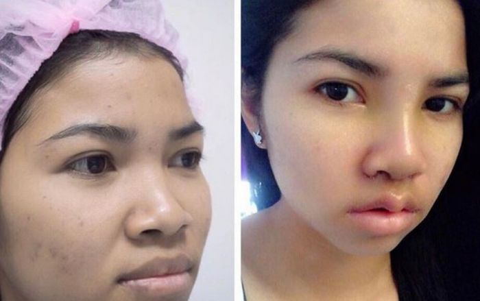 В Азии появился новый тренд в изменении формы губ