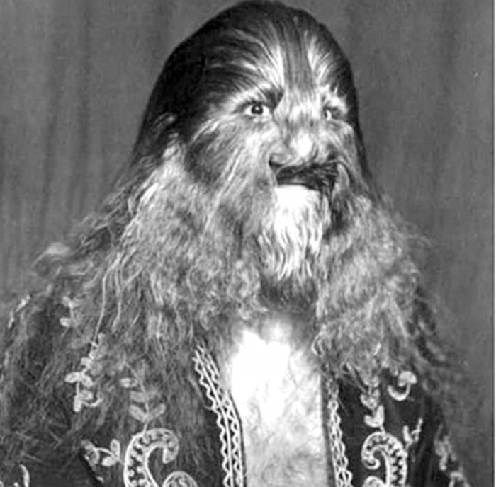 Истории и трагедии людей, выступавших в фрик-шоу Истории и трагедии людей, выступавших в фрик-шоу