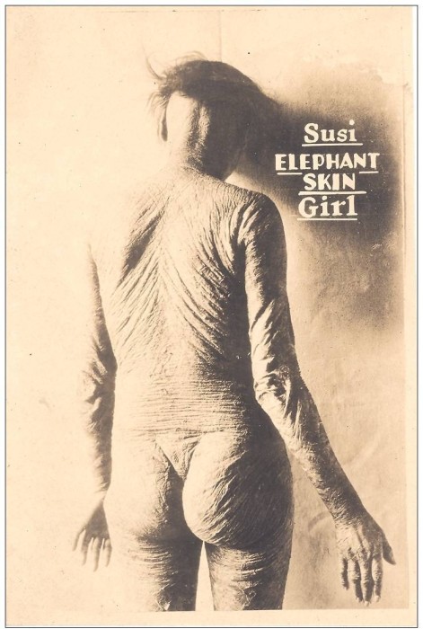 Истории и трагедии людей, выступавших в фрик-шоу Истории и трагедии людей, выступавших в фрик-шоу