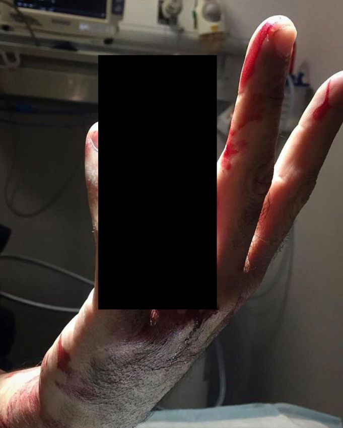 Хирурги делятся врачебным опытом в Инстаграме