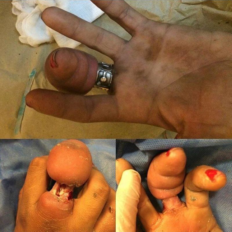 Хирурги делятся врачебным опытом в Инстаграме