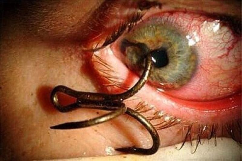 Хирурги делятся врачебным опытом в Инстаграме