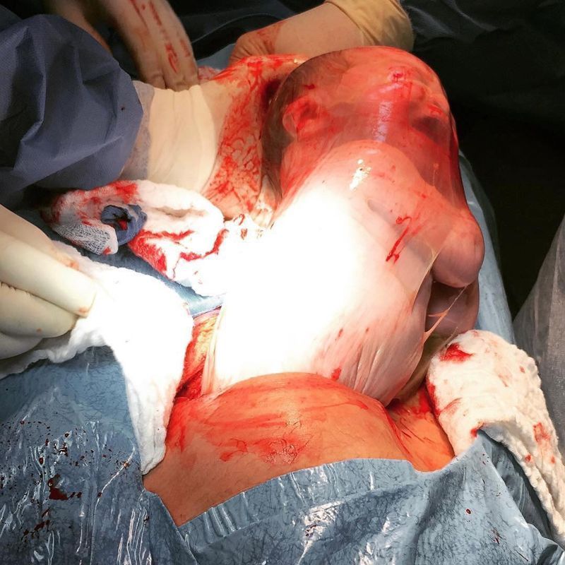 Хирурги делятся врачебным опытом в Инстаграме