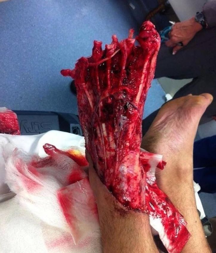 Хирурги делятся врачебным опытом в Инстаграме