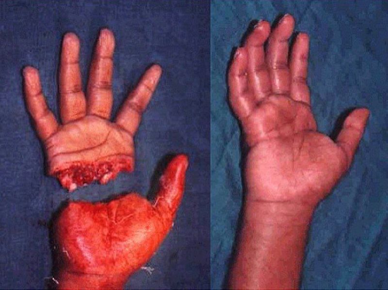 Хирурги делятся врачебным опытом в Инстаграме