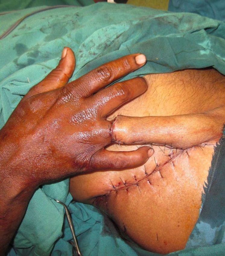 Хирурги делятся врачебным опытом в Инстаграме