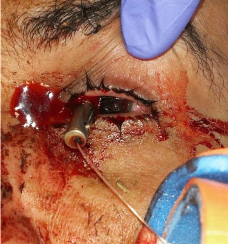 Хирурги делятся врачебным опытом в Инстаграме