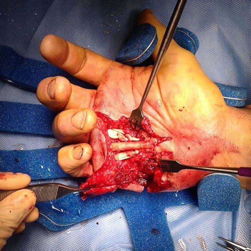 Хирурги делятся врачебным опытом в Инстаграме