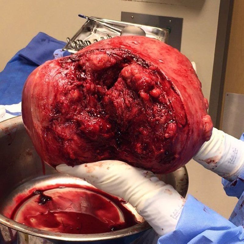 Хирурги делятся врачебным опытом в Инстаграме