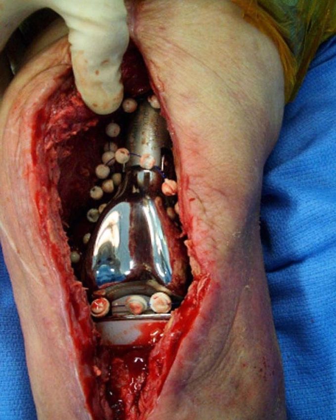 Хирурги делятся врачебным опытом в Инстаграме