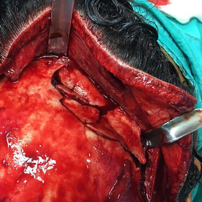 Хирурги делятся врачебным опытом в Инстаграме