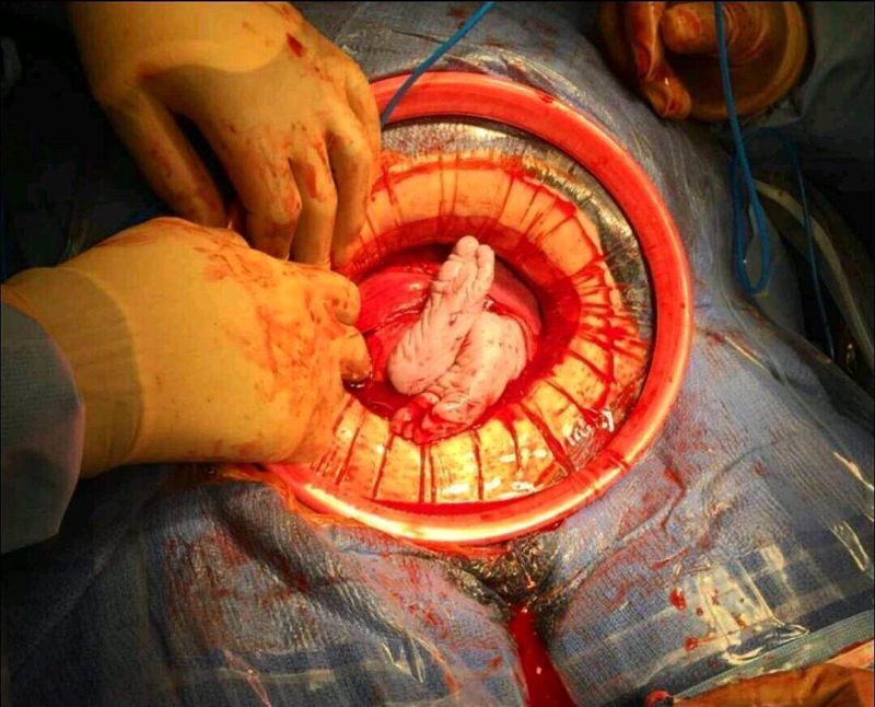 Хирурги делятся врачебным опытом в Инстаграме