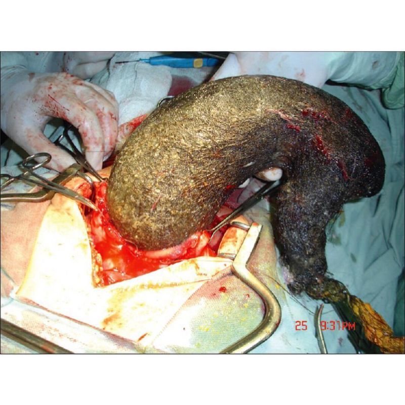 Хирурги делятся врачебным опытом в Инстаграме