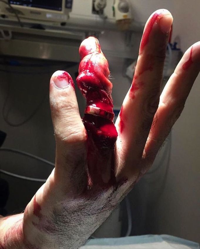 Хирурги делятся врачебным опытом в Инстаграме