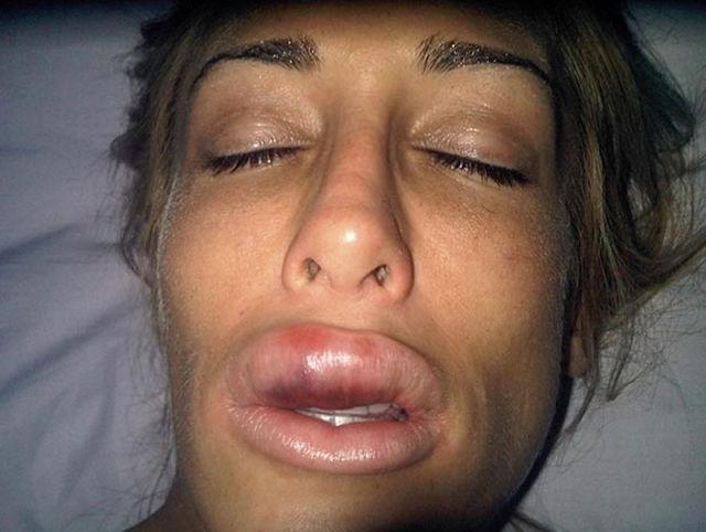 Девушка постоянно себя улучшала (23 фото)