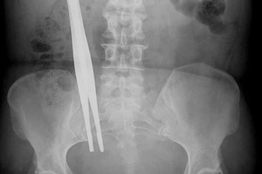 Ужасы медицины (9 фото)