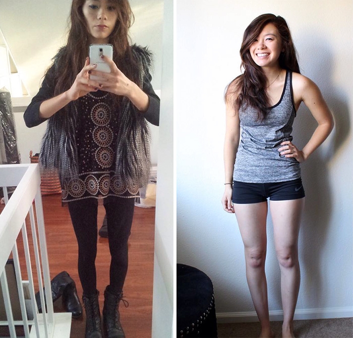 Потрясающее восстановление девушек, которые доказали, что анорексию можно победить