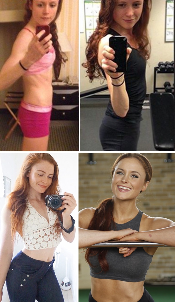 Потрясающее восстановление девушек, которые доказали, что анорексию можно победить