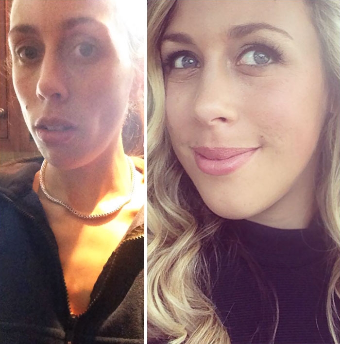 Потрясающее восстановление девушек, которые доказали, что анорексию можно победить