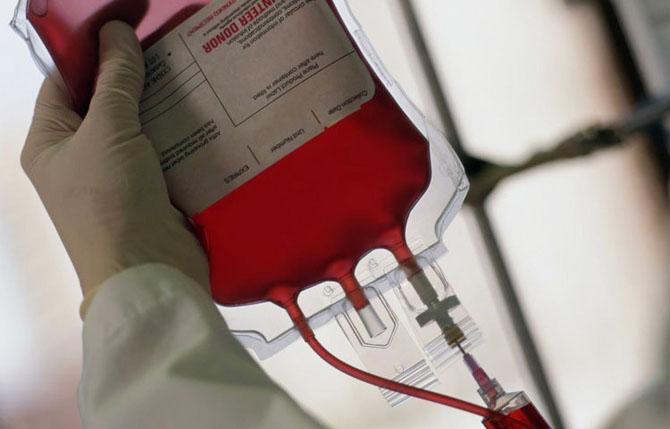 10 самых невероятных медицинских рекордов 10 самых невероятных медицинских рекордов