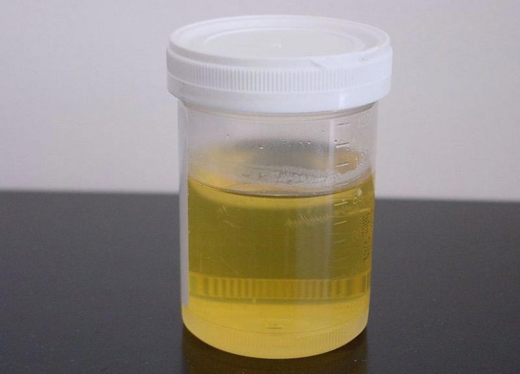 10 пугающих медицинских процедур, которые заставят вас радоваться тому, что вы живёте в современном мире