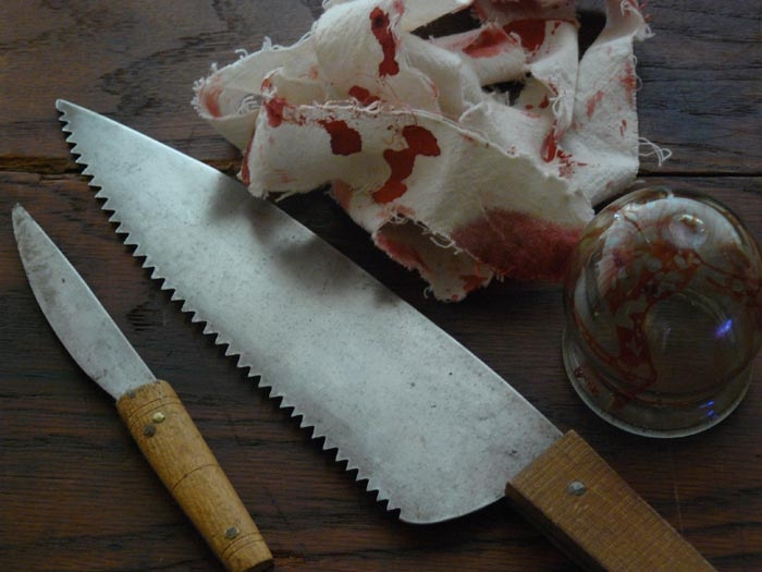 10 пугающих медицинских процедур, которые заставят вас радоваться тому, что вы живёте в современном мире