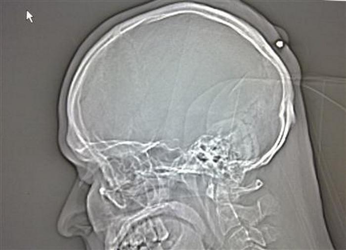 16 самых безумных поступков в истории человечества, которые никого не оставят равнодушным