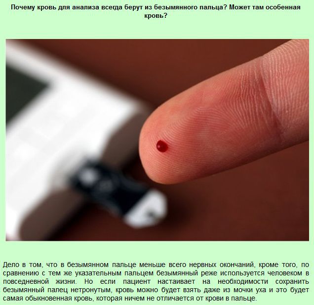 Интересные "почему" (13 фото)