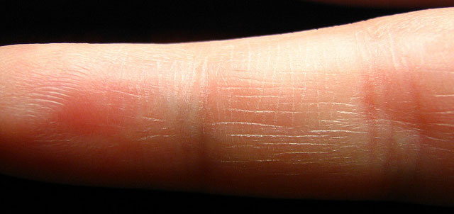 8 основных навыков оказания первой помощи, которыми должен владеть каждый