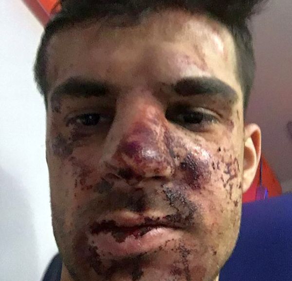 В Санкт-Петербурге у собственного дома избили игрока «Зенита» Дениса Терентьева