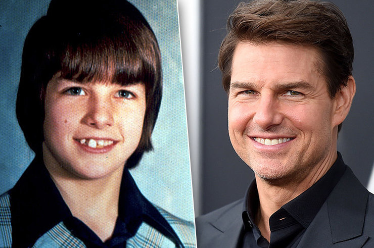 Звезды, которые в детстве были «гадкими утятами»