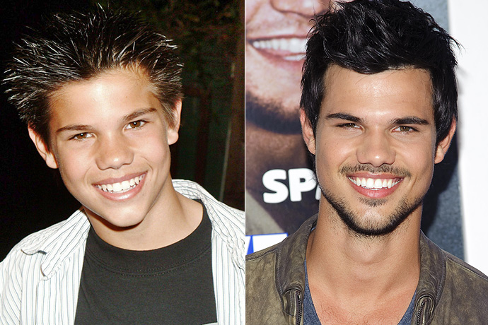 Звезды, которые в детстве были «гадкими утятами»