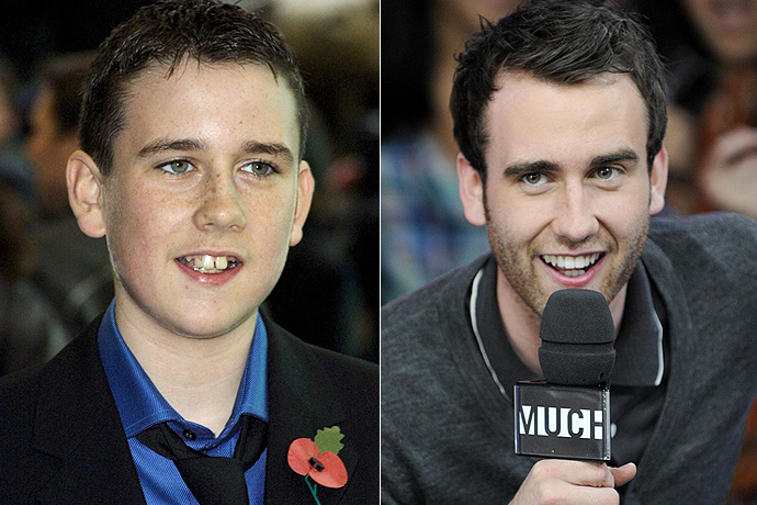 Звезды, которые в детстве были «гадкими утятами»