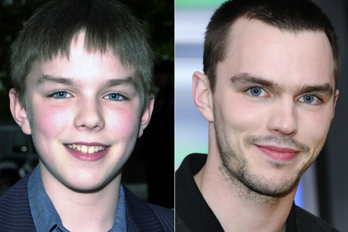 Звезды, которые в детстве были «гадкими утятами»