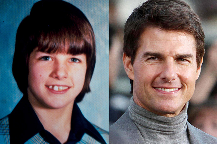 Звезды, которые в детстве были «гадкими утятами»